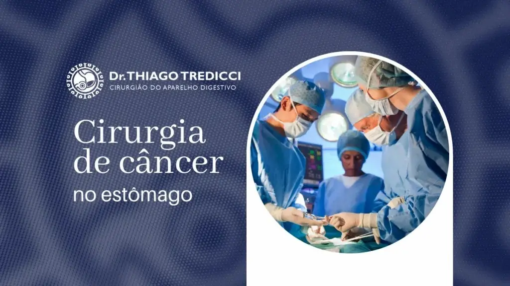 Cirurgia de Câncer no Estômago