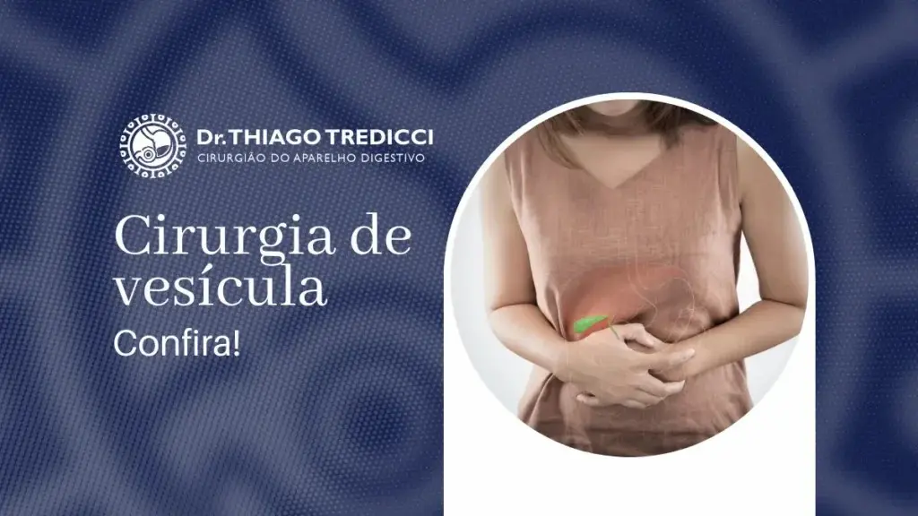 Cirurgia de Vesícula