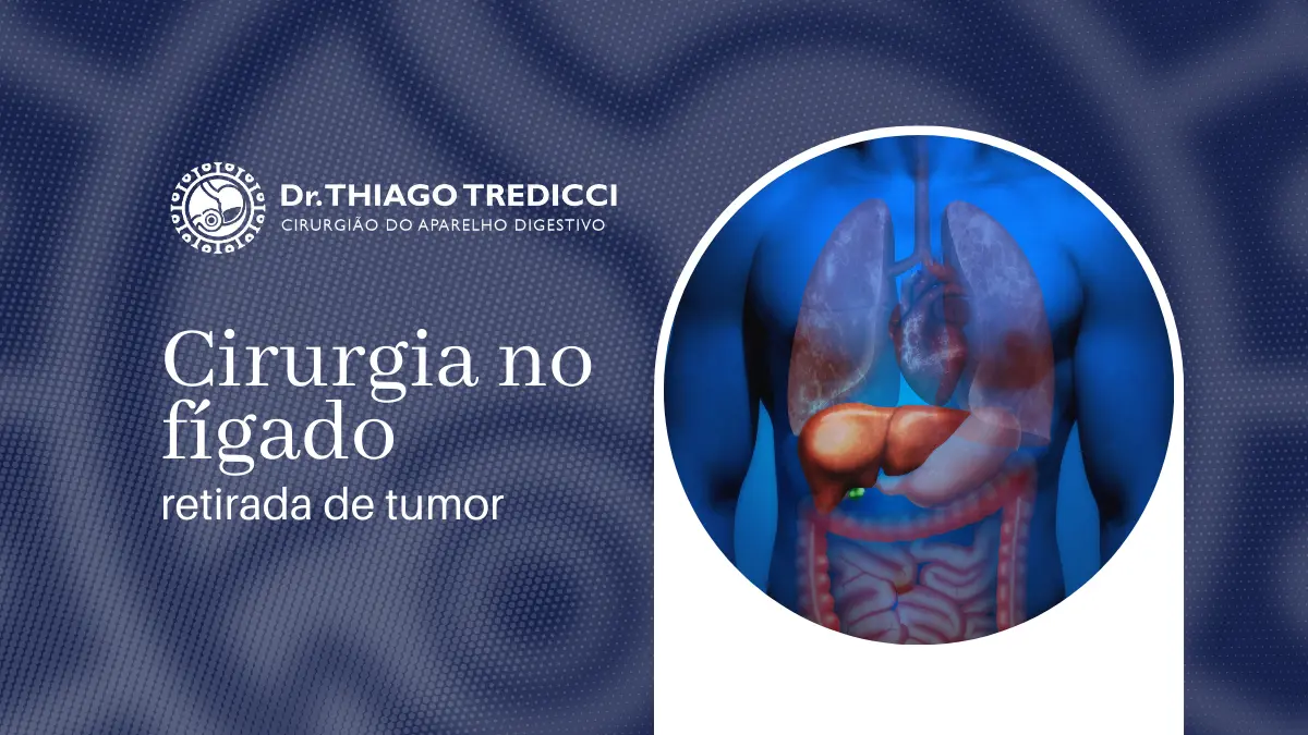 Cirurgia no Fígado