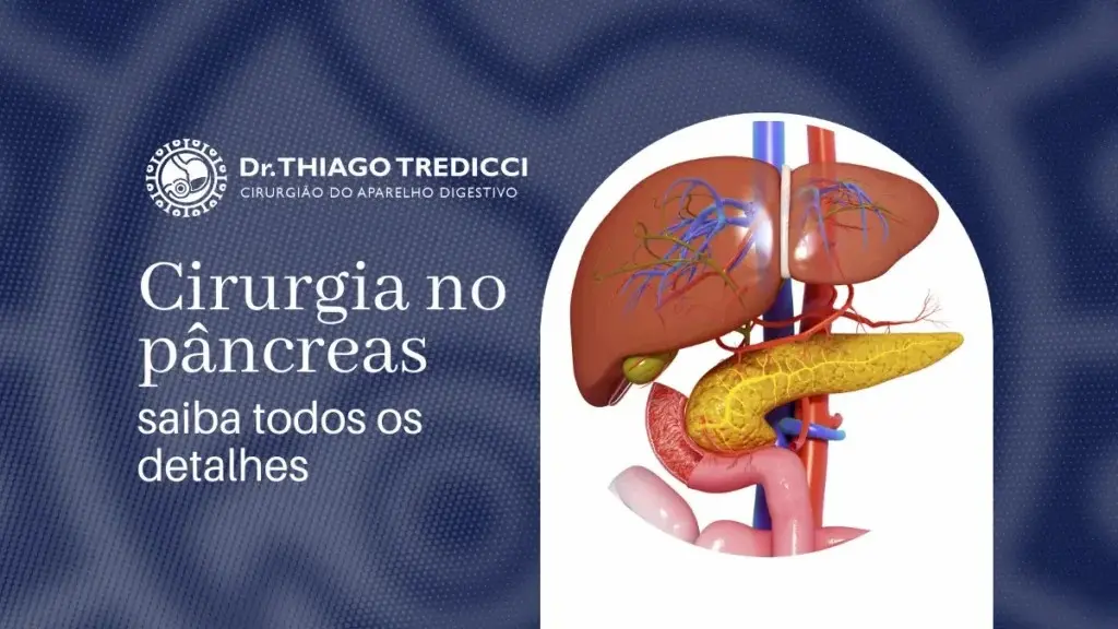 Cirurgia no Pâncreas
